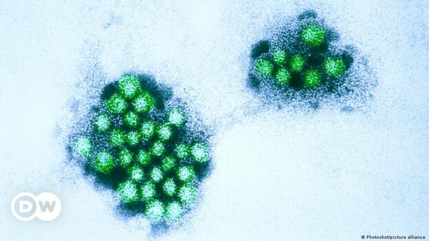 Highly contagious norovirus stomach bug hits Italian village – DW – 07/02/2024