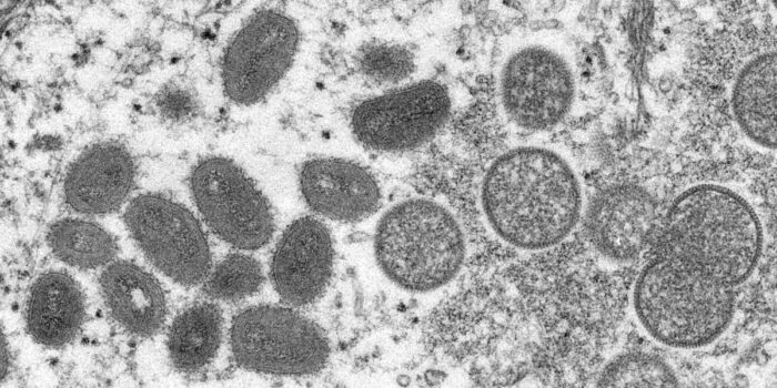 Experts Race to Contain a New Monkeypox Virus Before It Goes Global