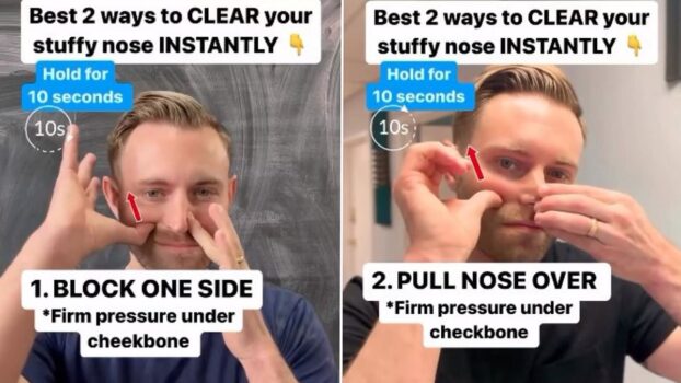 Health expert reveals 'amazing' hack that INSTANTLY clears a stuffy nose as hay fever season leaves hundreds suffering from congestion